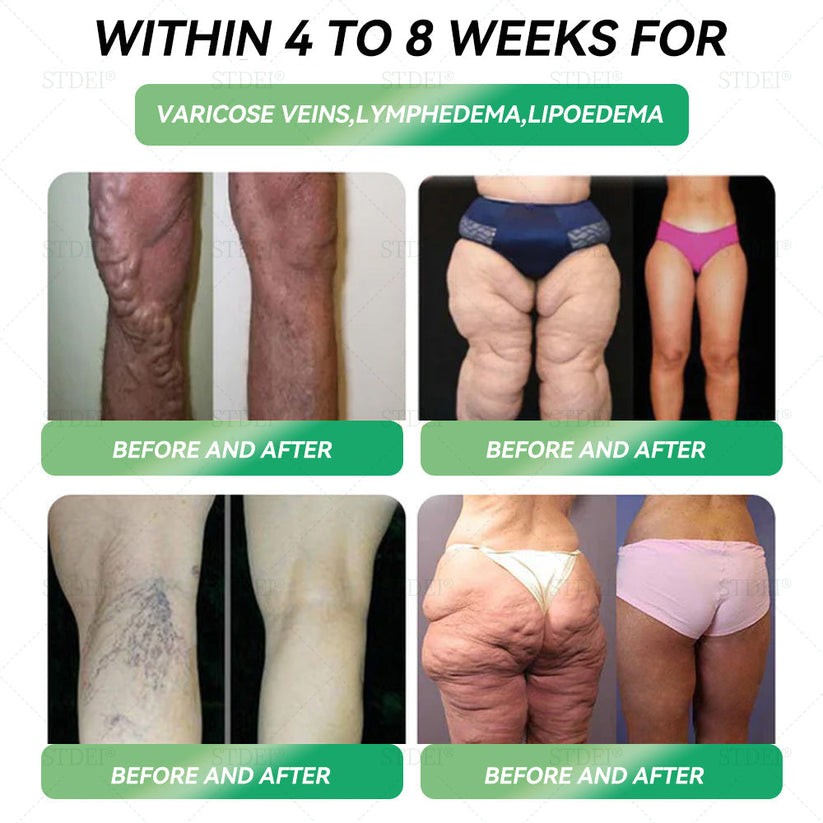 TotaI 𝑩𝒐𝒅𝒚 HeaIth Start 𝑯𝒆𝒓𝒆✅𝐓𝐒𝐄𝐋𝐃® 𝐆𝐋𝐏-𝟏 𝐒𝗹𝐢𝐦𝐦𝐢𝐧𝐠 🛡️& 𝐇𝐞𝐚𝗹𝐭𝐡 𝐈𝐦𝐩𝐫𝐨𝐯𝐞𝐦𝐞𝐧𝐭 𝐀𝐦𝐩𝐨𝐮𝗹𝐞 𝐃𝐫𝐨𝐩𝐬💎